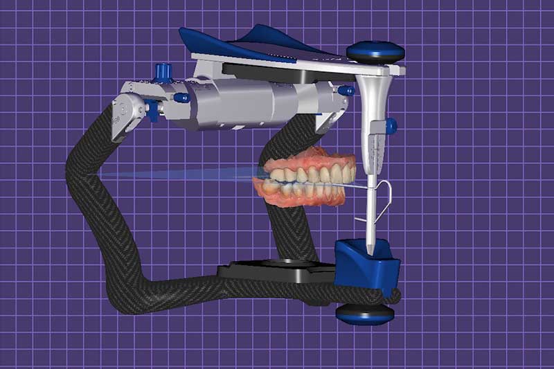 Occlusal Device Fabrication | Nova Prosthodontics