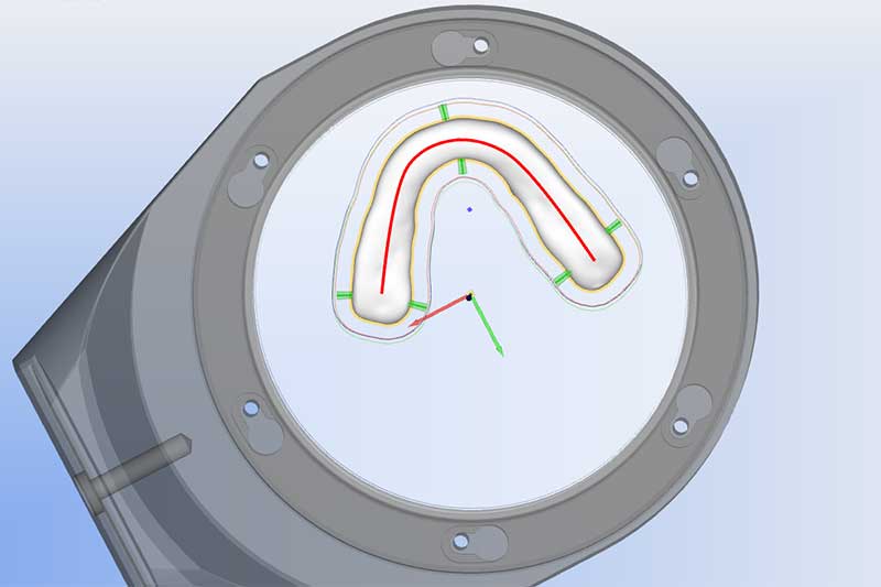 Occlusal Device Fabrication | Nova Prosthodontics