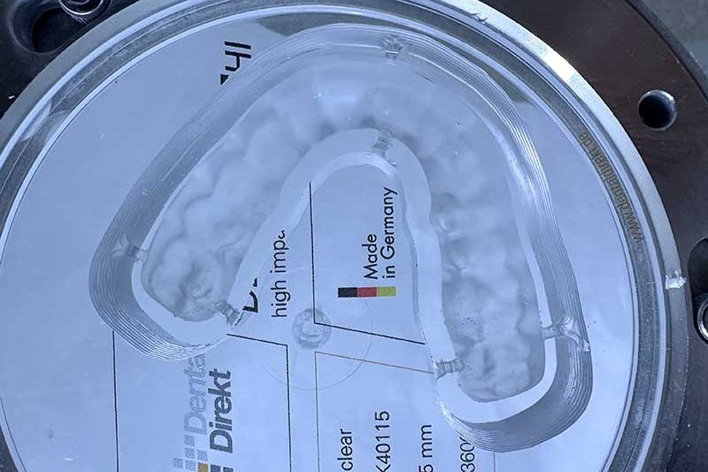 Occlusal Device Fabrication | Nova Prosthodontics