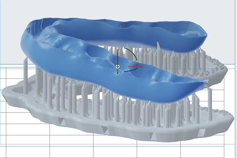 Occlusal Device Fabrication | Nova Prosthodontics